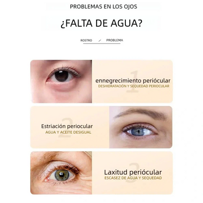 Kit Arroz Bioaqua™ x5