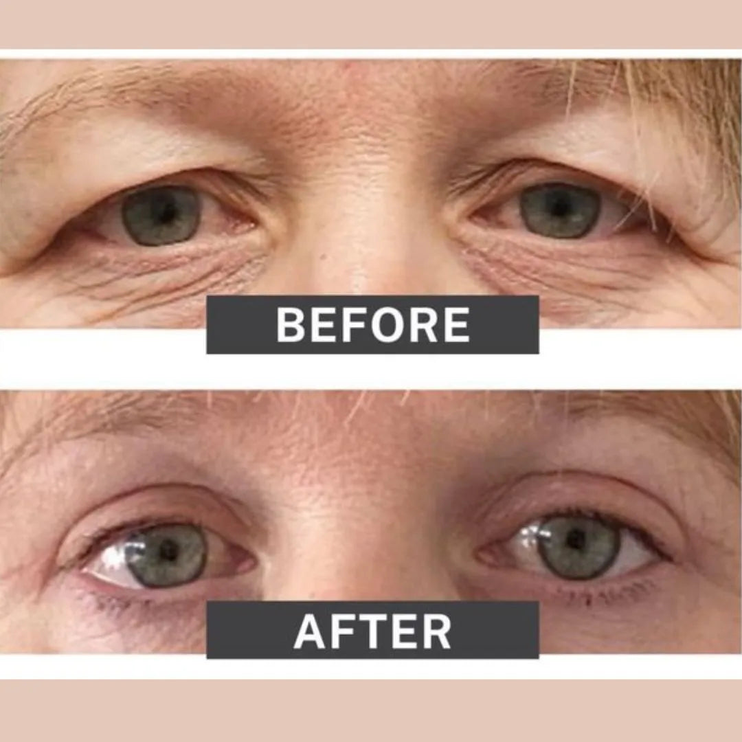 Lumiér® Lifting exprés para párpados