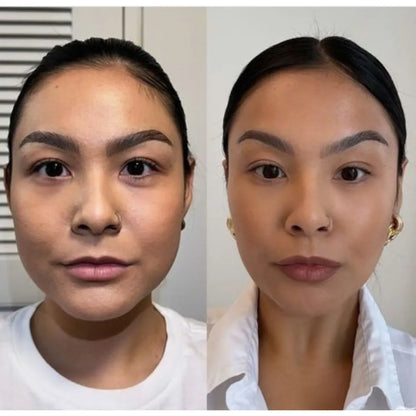 Lumiér® Lifting exprés para párpados